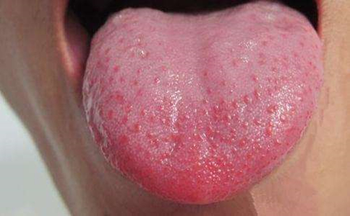 舌像颜色